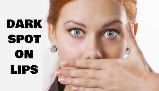 Dark Spot On Lips: Causes And Home Remedies